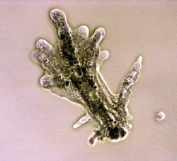 Amoeba_proteust.jpg